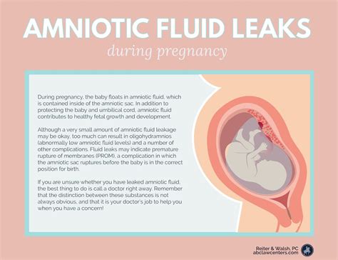 how do you know your leaking amniotic fluid|How can you tell if your slowly leaking amniotic fluid versus just ...